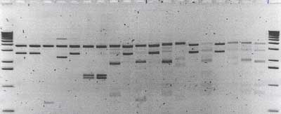 Elektrophoresegel